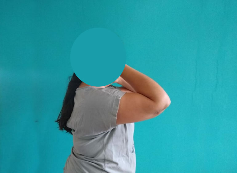 Imagen de caso clínico 1