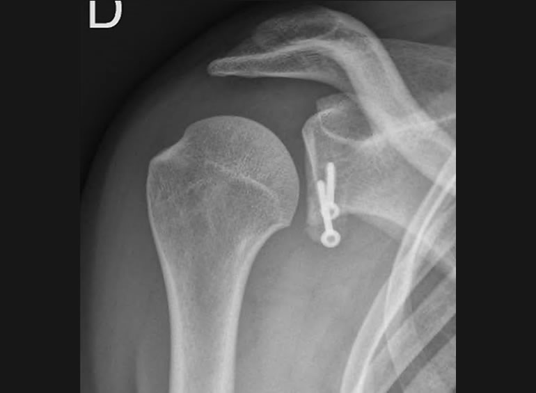 Imagen de caso clínico 2