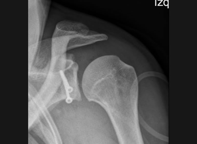 Imagen de caso clínico 2