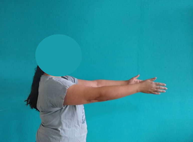 Imagen de caso clínico 1