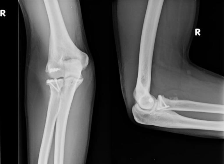 Imagen de caso clínico 4